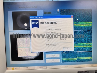 OCT&nbsp;|&nbsp;Carl Zeiss&nbsp;|&nbsp;Cirrus 4000 HD OCT