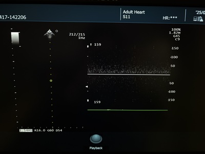 Ultrasound System&nbsp;|&nbsp;FUJIFILM&nbsp;|&nbsp;ARIETTA 50