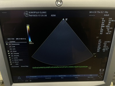 Color Doppler&nbsp;|&nbsp;GE&nbsp;|&nbsp;LOGIQ P5