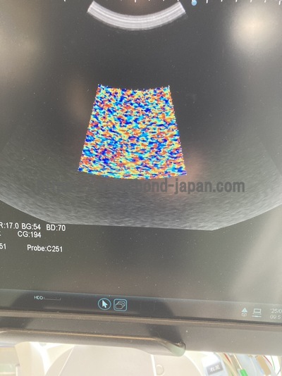 &nbsp;|&nbsp;Fujifilm&nbsp;|&nbsp;ARIETTA 70