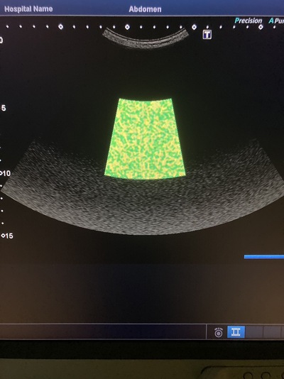 Color Doppler&nbsp;|&nbsp;CANON&nbsp;|&nbsp;Xario 200