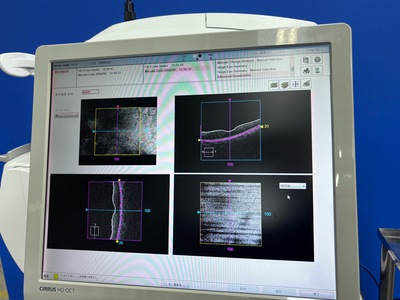 OCT&nbsp;|&nbsp;Carl Zeiss&nbsp;|&nbsp;Cirrus 500 HD-OCT Plus