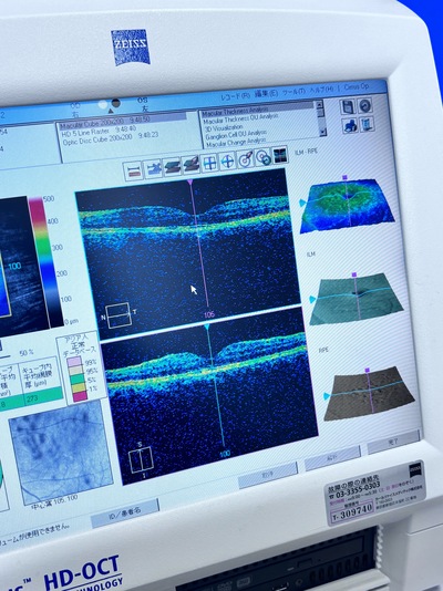 OCT&nbsp;|&nbsp;Carl Zeiss&nbsp;|&nbsp;Cirrus 4000 HD OCT