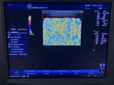 Color Doppler&nbsp;|&nbsp;GE&nbsp;|&nbsp;LOGIQ P5