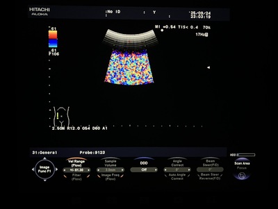 Color Doppler&nbsp;|&nbsp;HITACHI&nbsp;|&nbsp;F37