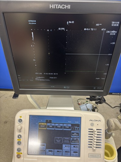 Ultrasound System&nbsp;|&nbsp;HITACHI&nbsp;|&nbsp;ARIETTA 60