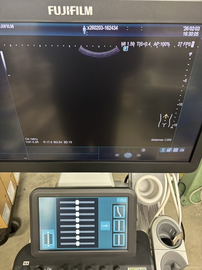 超音波診断装置&nbsp;|&nbsp;富士フイルムメディカル&nbsp;|&nbsp;ARIETTA 650 DeepInsightの写真