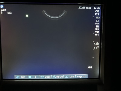 Color Doppler&nbsp;|&nbsp;SonoSite&nbsp;|&nbsp;M-Turbo