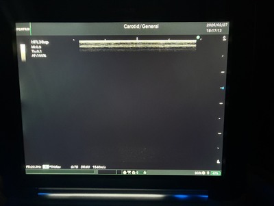 Portable Ultrasound&nbsp;|&nbsp;FUJIFILM&nbsp;|&nbsp;FC1-X