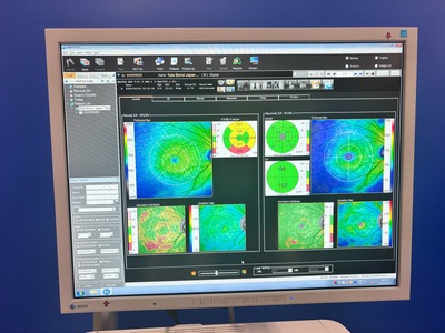 OCT with Fundus function&nbsp;|&nbsp;NIDEK&nbsp;|&nbsp;RS-3000 Advance