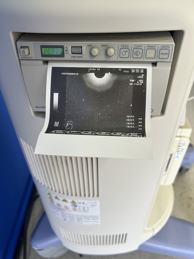 BW System&nbsp;|&nbsp;ALOKA&nbsp;|&nbsp;Prosound 6