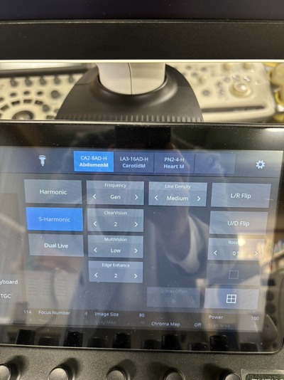 Ultrasound&nbsp;|&nbsp;FUJIFILM&nbsp;|&nbsp;FUTUS