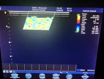 Color Doppler&nbsp;|&nbsp;GE&nbsp;|&nbsp;Vivid i