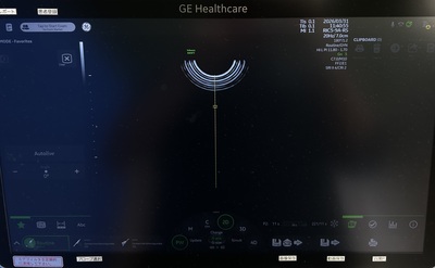 4D Ultrasound&nbsp;|&nbsp;GE&nbsp;|&nbsp;Voluson Swift BT23