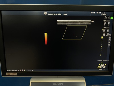 Ultrasound&nbsp;|&nbsp;GE&nbsp;|&nbsp;LOGIQ P9