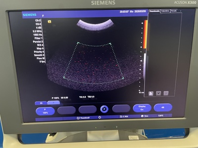 Color Doppler&nbsp;|&nbsp;SIEMENS&nbsp;|&nbsp;X300 PE