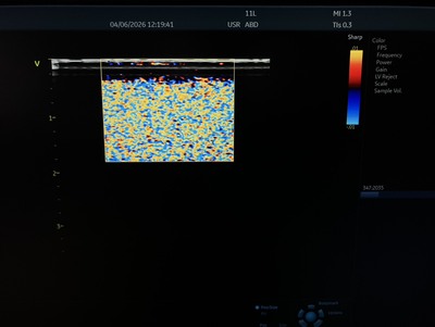 Ultrasound System&nbsp;|&nbsp;GE&nbsp;|&nbsp;Vivid S60N