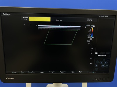 Ultrasound System&nbsp;|&nbsp;CANON&nbsp;|&nbsp;Aplio Go
