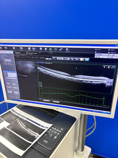 OCT with Fundus function&nbsp;|&nbsp;NIDEK&nbsp;|&nbsp;RS-3000