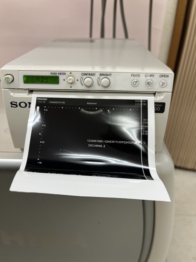 Color Doppler&nbsp;|&nbsp;CANON&nbsp;|&nbsp;TUS-X100 Xario 100