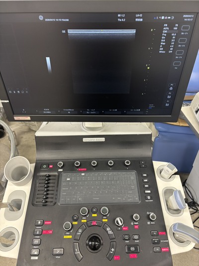 超音波診断装置&nbsp;|&nbsp;GEヘルスケア・ジャパン株式会社&nbsp;|&nbsp;Versana Balanceの写真