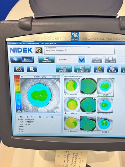 Wavefront Aberrometer&nbsp;|&nbsp;NIDEK&nbsp;|&nbsp;OPD-Scan III