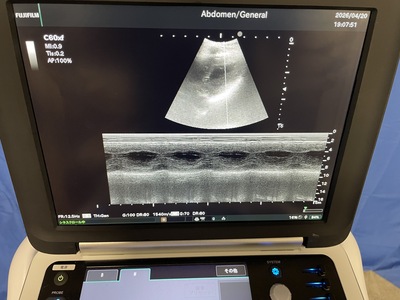Portable Ultrasound&nbsp;|&nbsp;FUJIFILM&nbsp;|&nbsp;FC1-X
