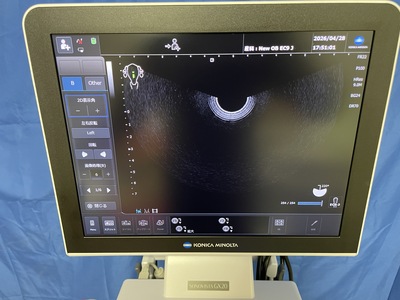Ultrasound System&nbsp;|&nbsp;konica&nbsp;|&nbsp;SONOVISTA GX20