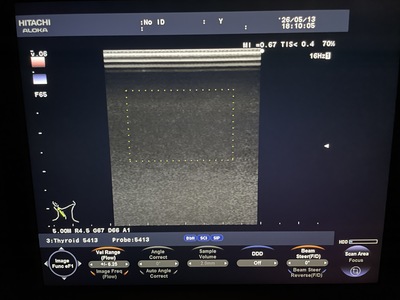 Color Doppler&nbsp;|&nbsp;HITACHI&nbsp;|&nbsp;F37