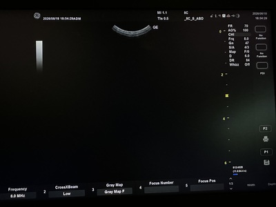 Ultrasound&nbsp;|&nbsp;GE&nbsp;|&nbsp;Versana Active