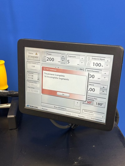 glaucoma Laser - PSLT (Pattern Scanning Laser Trabeculoplasty)&nbsp;|&nbsp;TOPCON (IRIDEX)&nbsp;|&nbsp;PASCAL Streamline Yellow