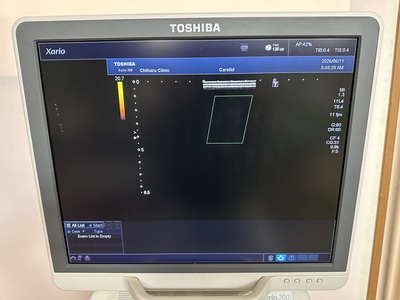 Color Doppler&nbsp;|&nbsp;CANON&nbsp;|&nbsp;Xario 200