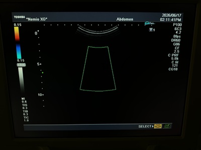 Color Doppler&nbsp;|&nbsp;CANON&nbsp;|&nbsp;SSA-580A Nemio XG