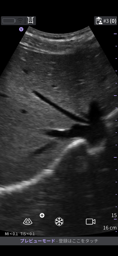 汎用超音波画像診断装置&nbsp;|&nbsp;GEヘルスケア・ジャパン株式会社&nbsp;|&nbsp;Vscan Air CLの写真