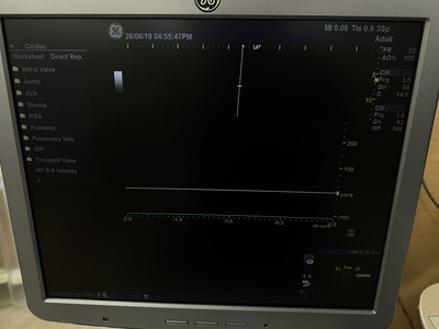 Color Doppler&nbsp;|&nbsp;GE&nbsp;|&nbsp;Logiq S7 Expert