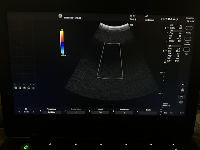 Portable Color doppler&nbsp;|&nbsp;GE&nbsp;|&nbsp;Versana Active