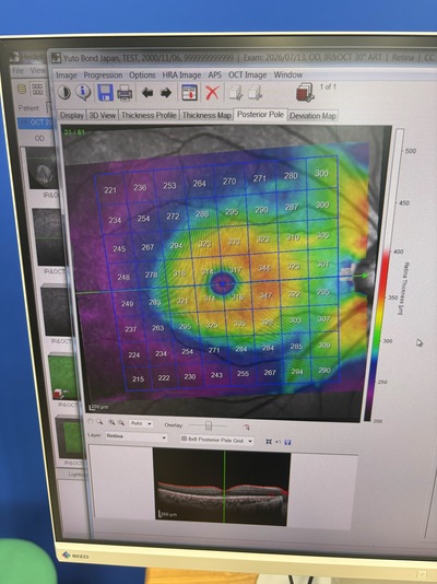 HRA2+ OCT+ WWE(55°), Retina and Glaucoma Module&nbsp;|&nbsp;Heidelberg Engineering GmbH&nbsp;|&nbsp;SPECTRALIS OCT2