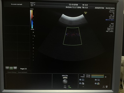 4D Ultrasound&nbsp;|&nbsp;GE&nbsp;|&nbsp;Voluson E8