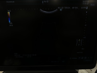 Ultrasound&nbsp;|&nbsp;FUJIFILM&nbsp;|&nbsp;ARIETTA 850SE