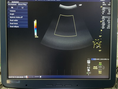 Color Doppler&nbsp;|&nbsp;GE&nbsp;|&nbsp;Logiq S7 Expert
