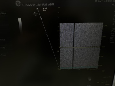 Color Doppler&nbsp;|&nbsp;GE&nbsp;|&nbsp;Logiq S7 Expert