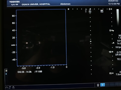 Color Doppler&nbsp;|&nbsp;CANON&nbsp;|&nbsp;Aplio 400