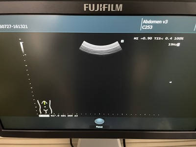 Ultrasound System&nbsp;|&nbsp;FUJIFILM&nbsp;|&nbsp;ARIETTA 50