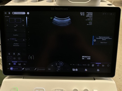 4D Ultrasound&nbsp;|&nbsp;GE&nbsp;|&nbsp;Voluson Swift BT23