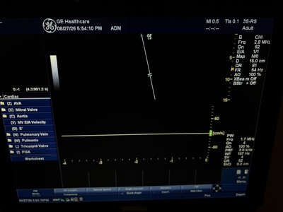 Color Doppler&nbsp;|&nbsp;GE&nbsp;|&nbsp;LOGIQ e Expert