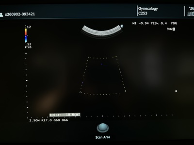 Ultrasound System&nbsp;|&nbsp;FUJIFILM&nbsp;|&nbsp;ARIETTA 50