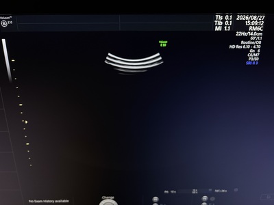 4D Ultrasound&nbsp;|&nbsp;GE&nbsp;|&nbsp;Voluson E10 BT20