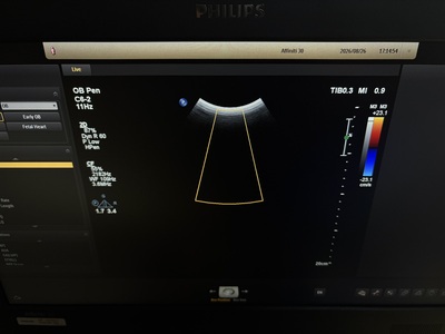 Ultrasound&nbsp;|&nbsp;Philips&nbsp;|&nbsp;Affiniti 30