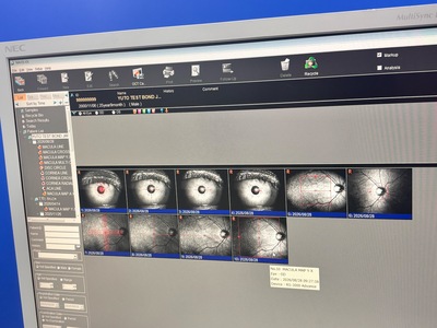 Fully Refurbished OCT with Angiography + Anterior Lens kit&nbsp;|&nbsp;NIDEK&nbsp;|&nbsp;RS-3000 Advance