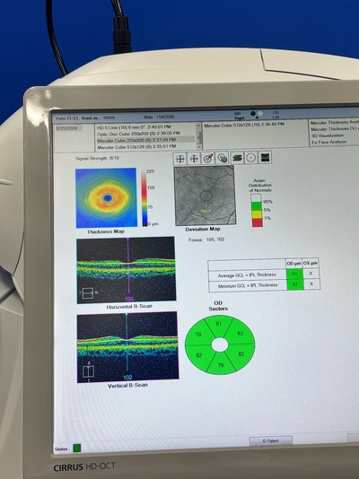 Making high-precision OCT more accessible. A feature-packed model that dramatically elevates the quality of daily clinical practice.&nbsp;|&nbsp;Carl Zeiss&nbsp;|&nbsp;Cirrus 500 HD-OCT Plus